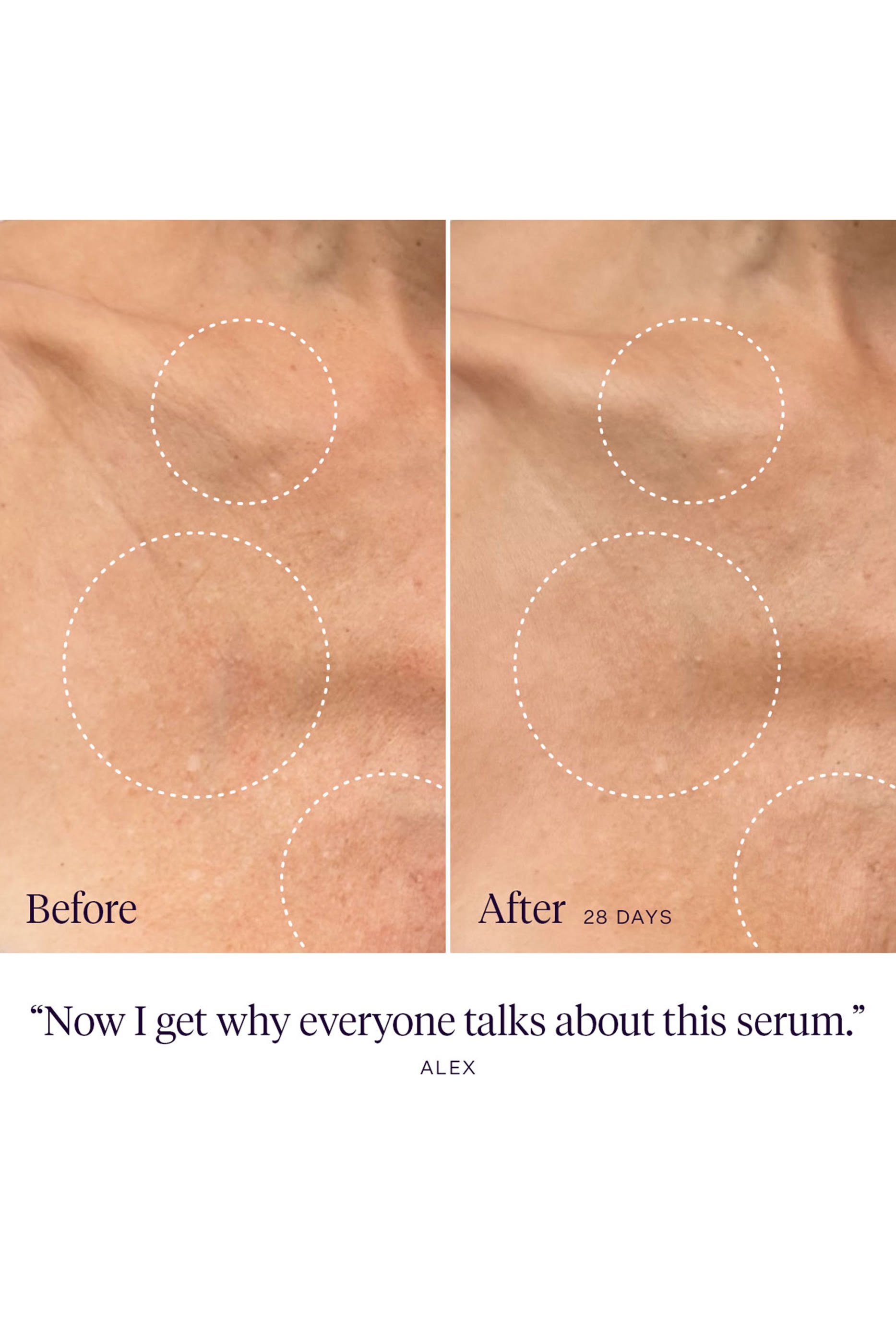 سيروم داي دريمر للجسم