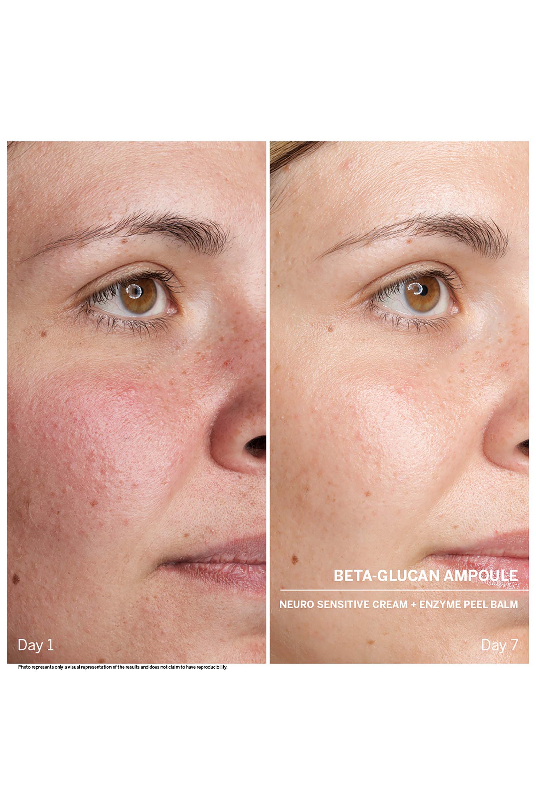 مجموعة أمبولة باور سيروم: بيتا جلوكان، 7 قطع