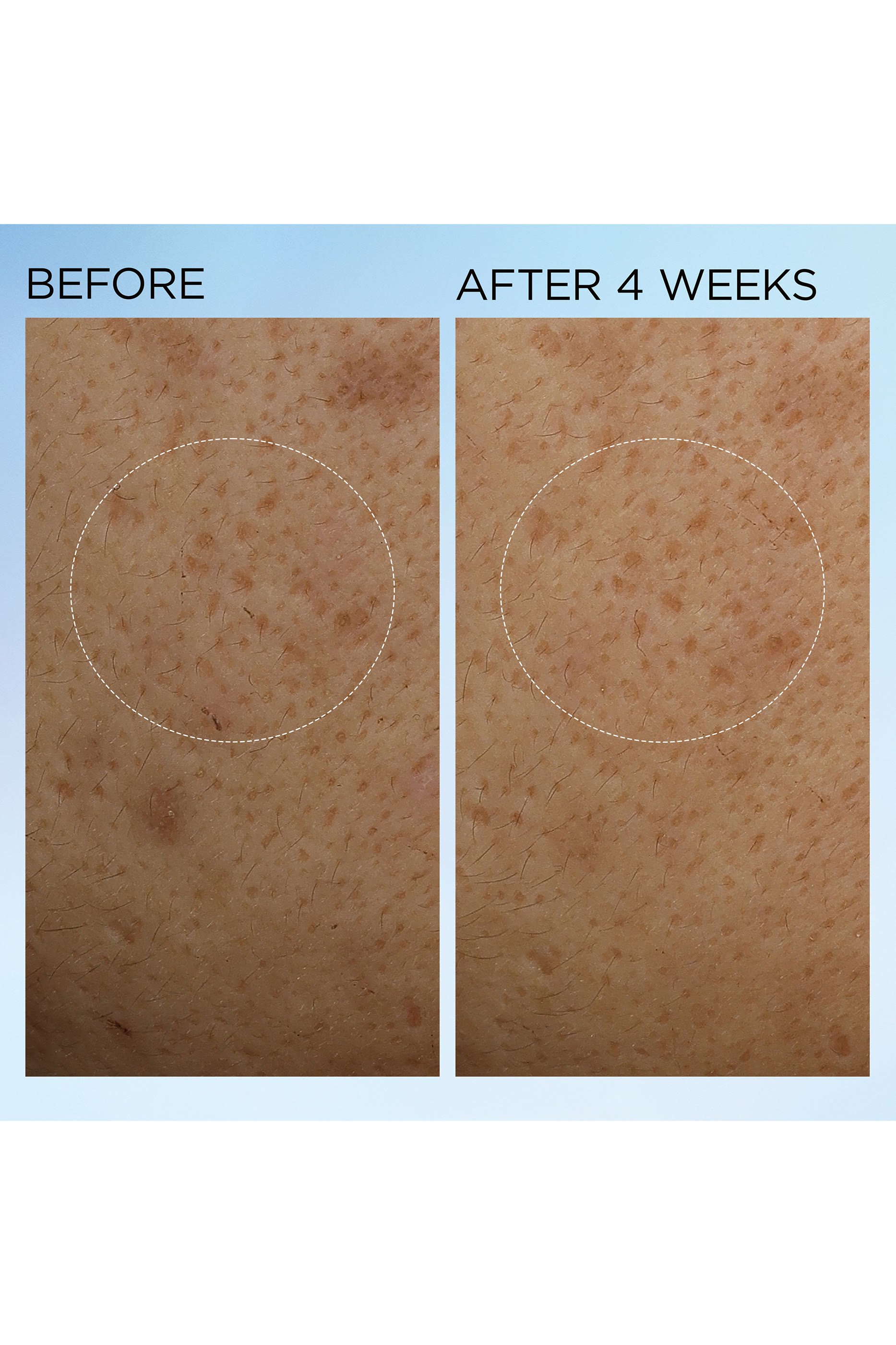 كريم لتفتيح البشرة وإكسابها الإشراق والمرونة بشكل ملحوظ