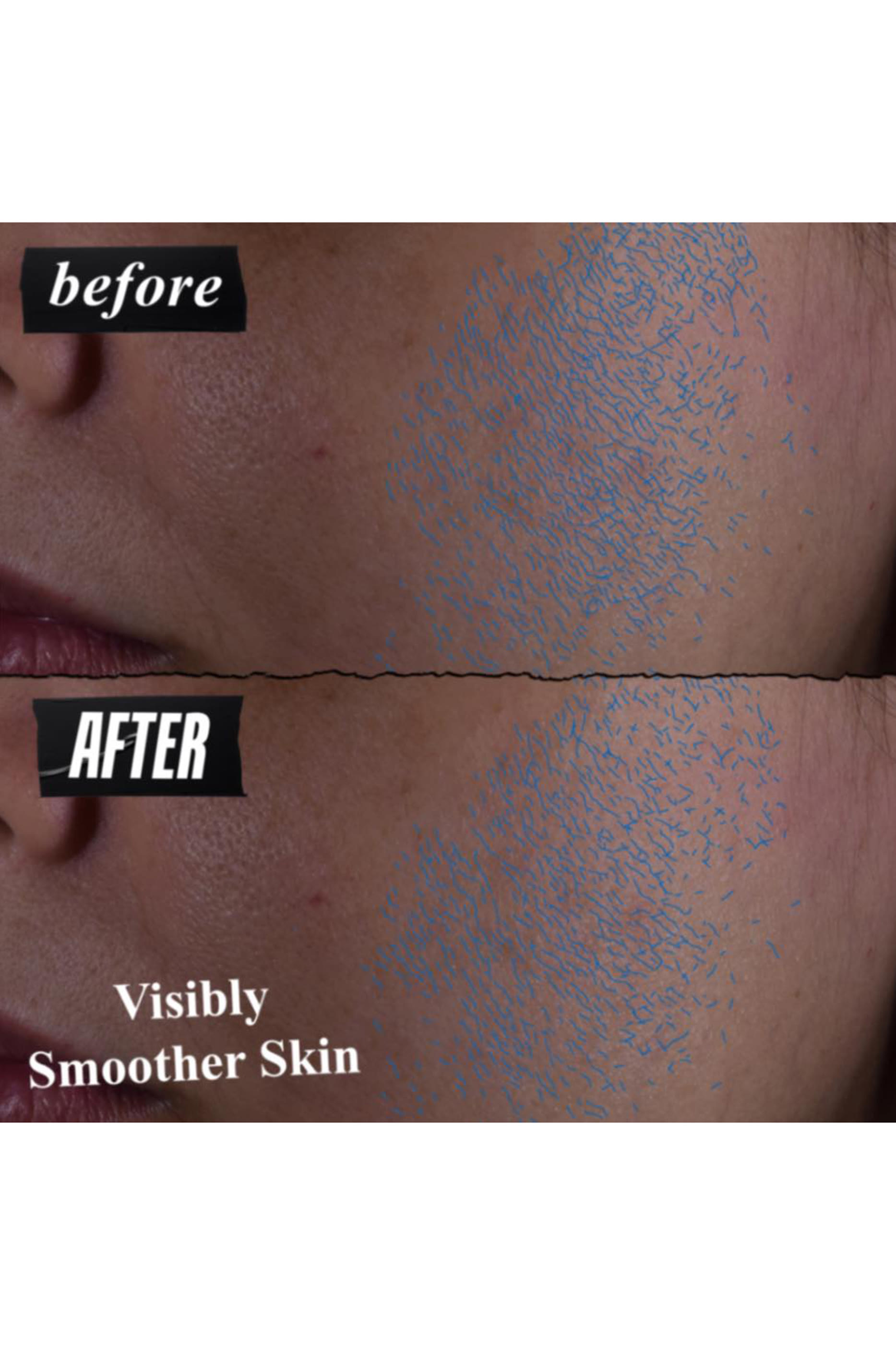 سيروم يومي كليرلي كوريكتيف لتقشير البشرة وتجديدها بالأحماض الثلاثية