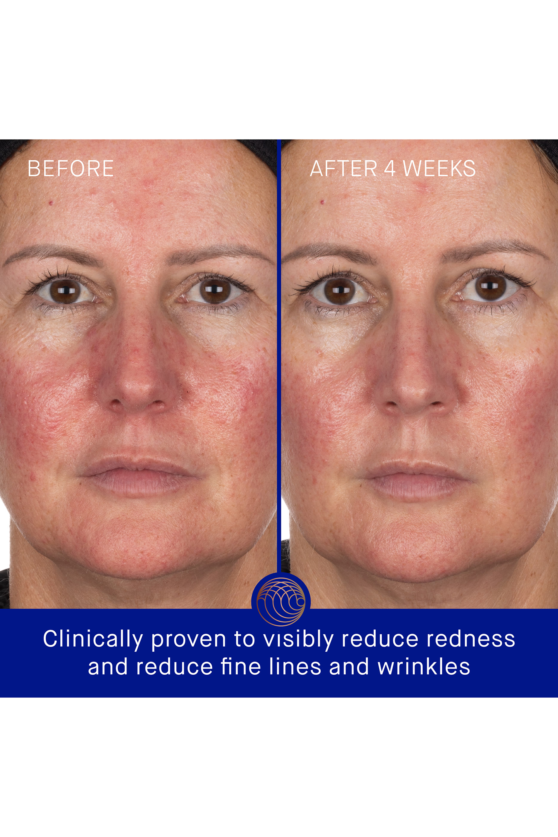 قناع هيدروجيل للوجه