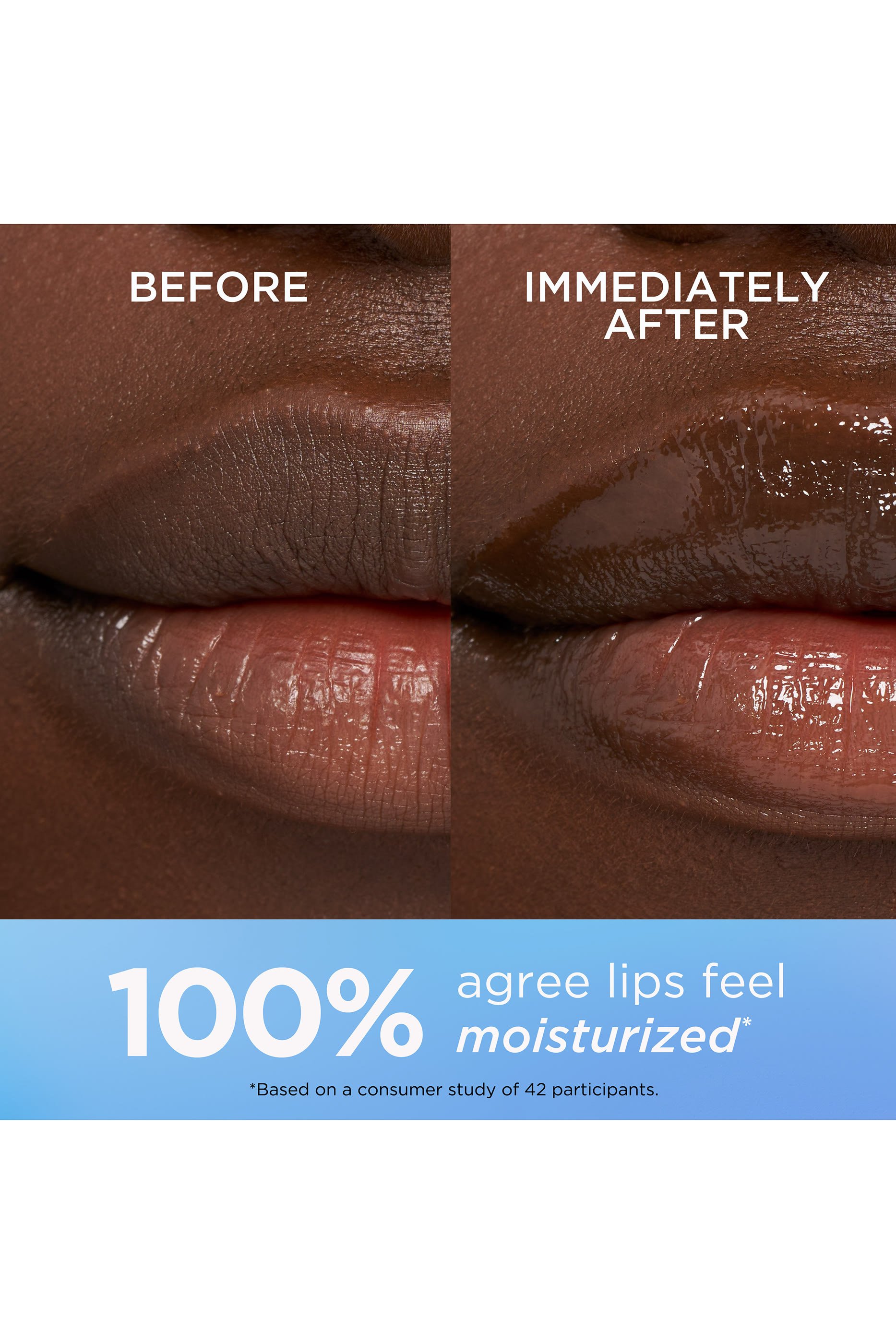 مرطب ايت اور لحماية الشفاه من أشعة الشمس بعامل SPF 15