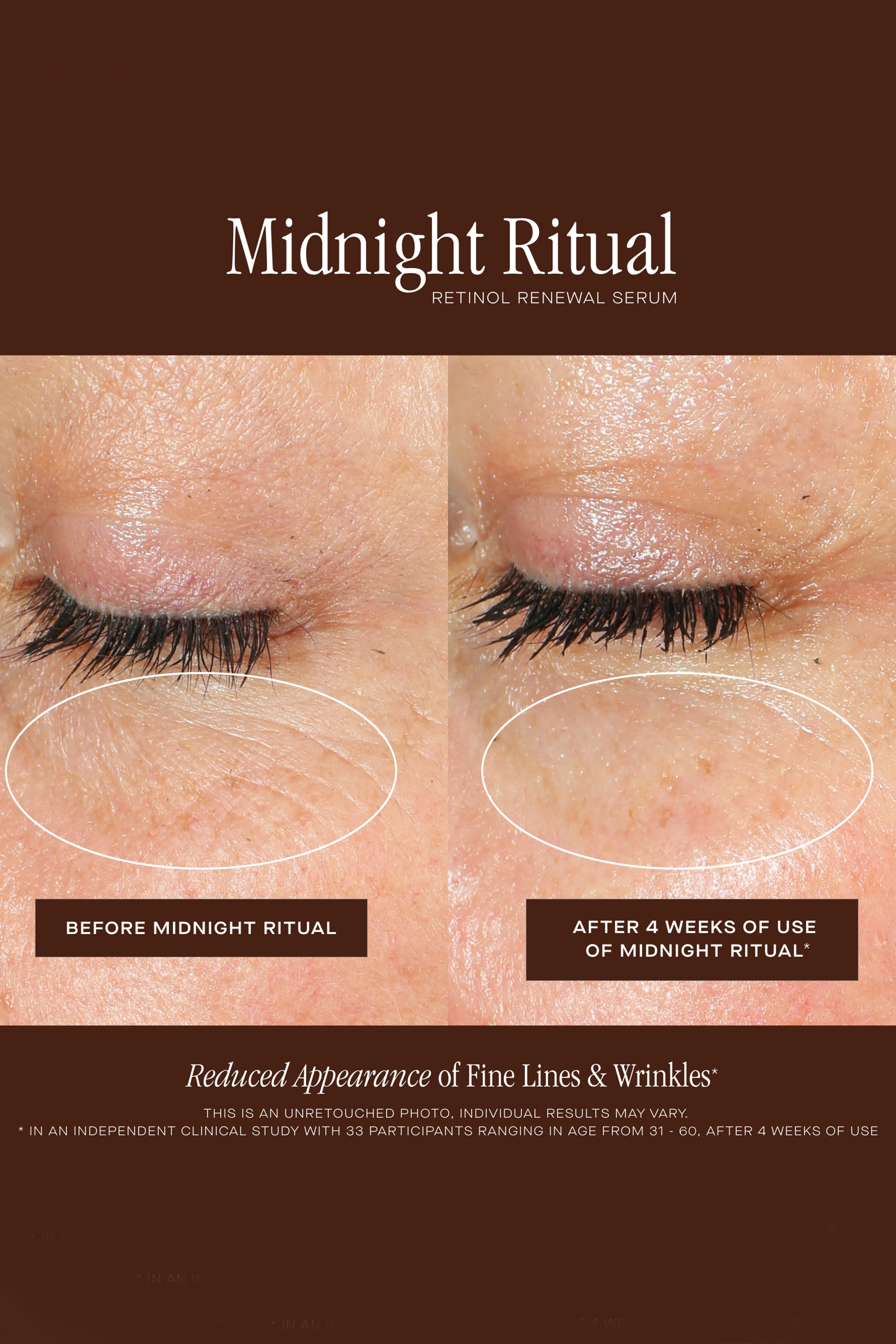 سيروم ليلي ريتوال ريتينول