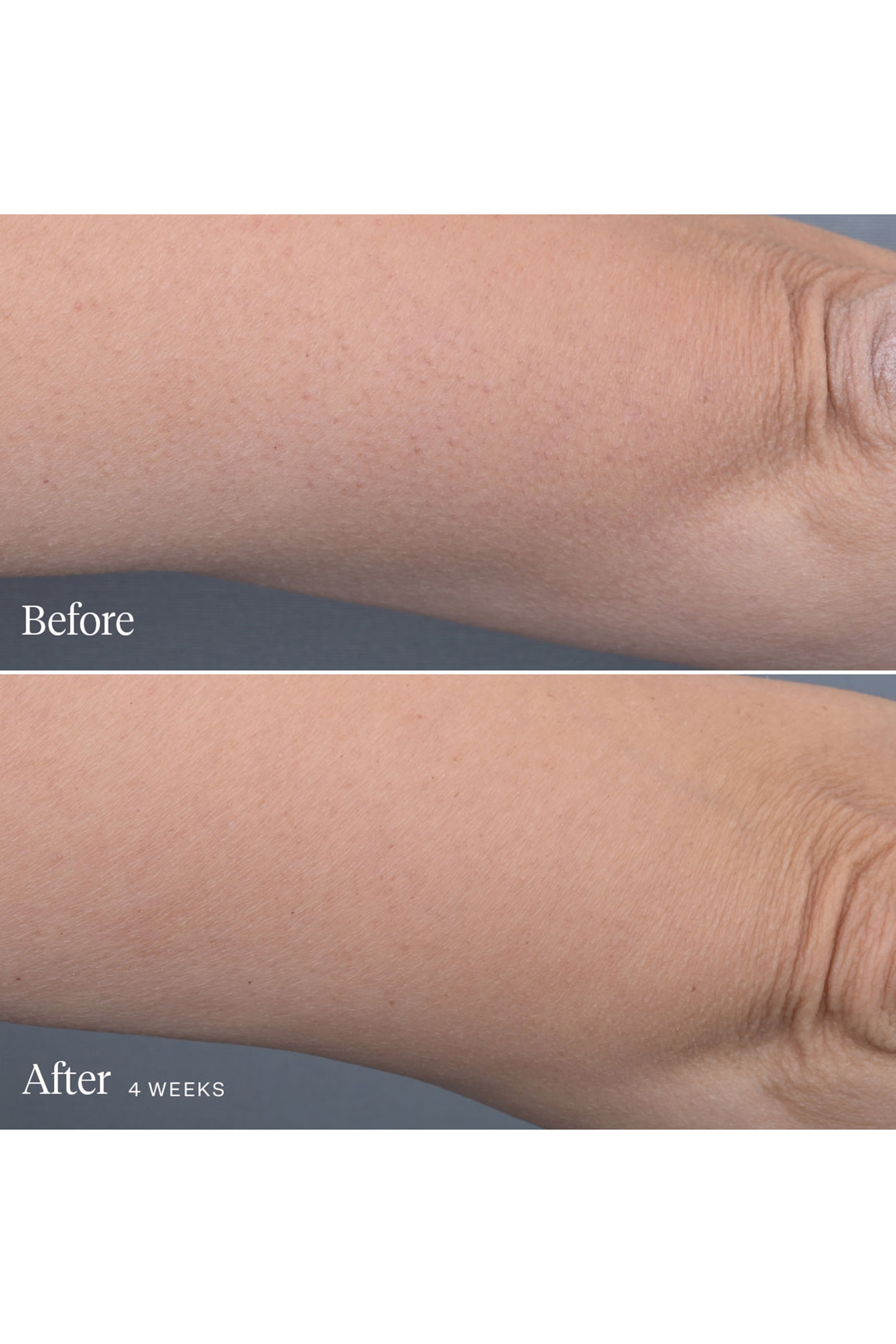 سيروم الجسم كاليدوسكوب لتنعيم البشرة