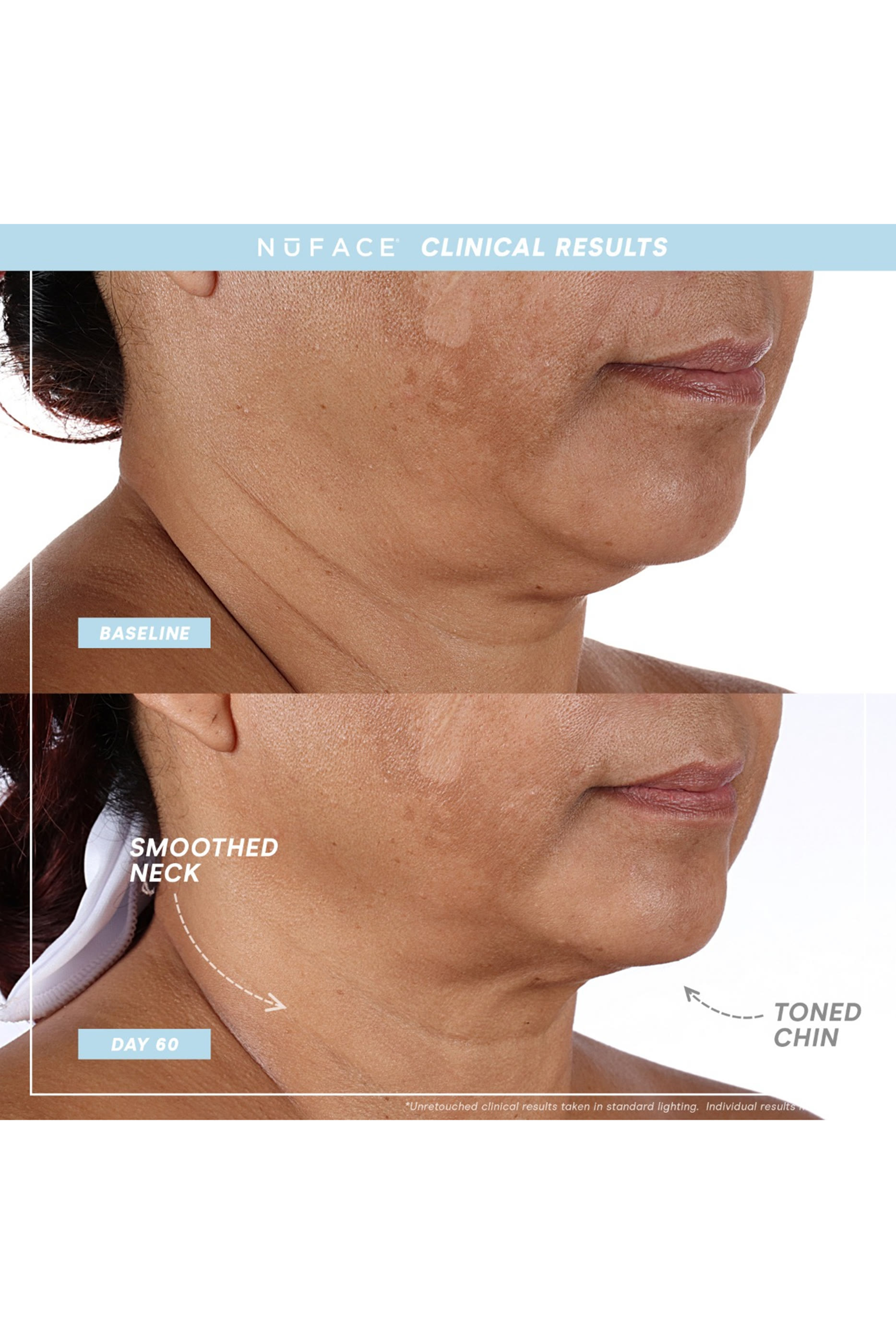 مجموعة أدوات ترينيتي بلس إيلي وتي دبليو ار