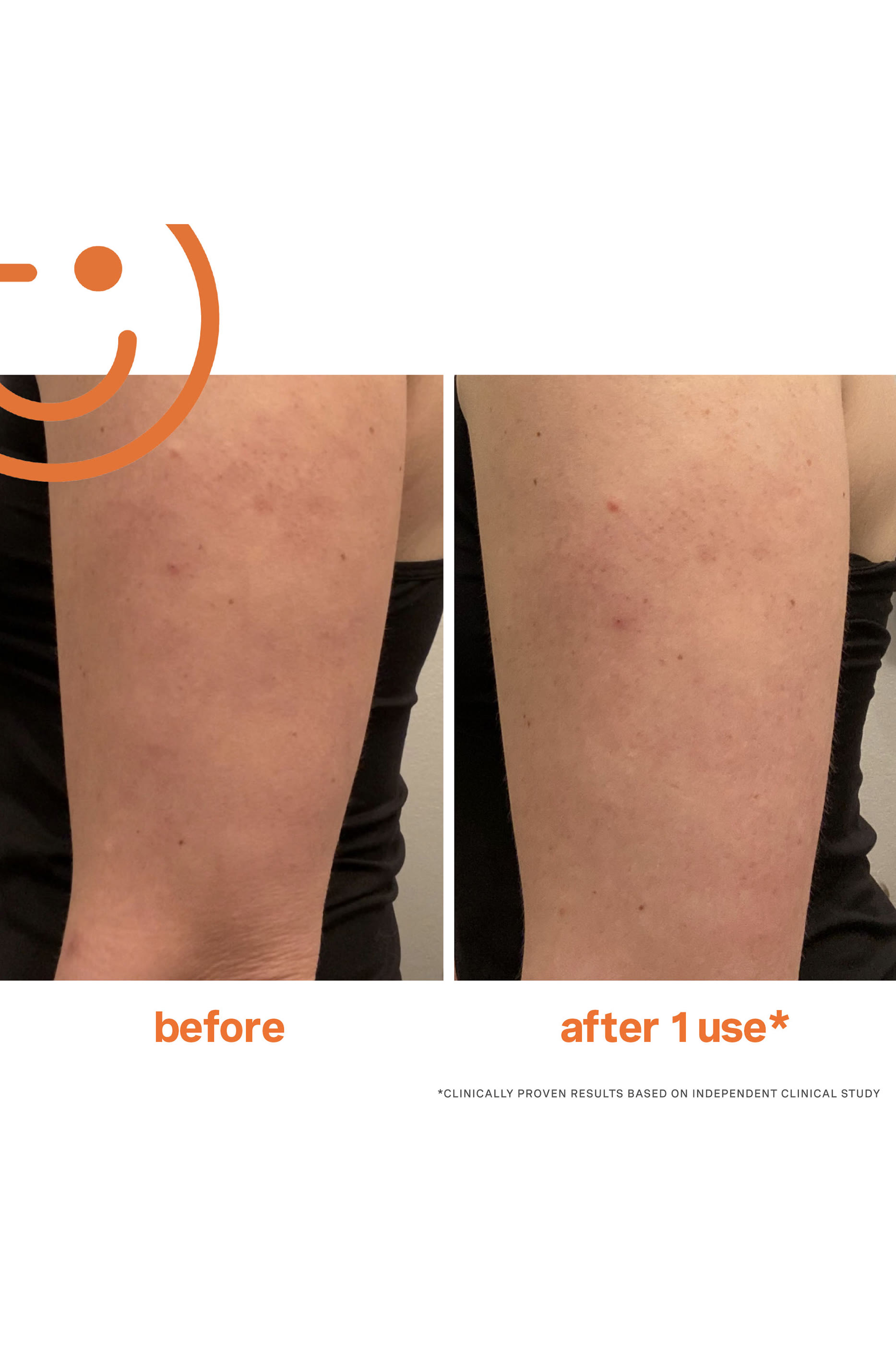 مقشر اكسفوليكيت ريسورفيسين للجسم