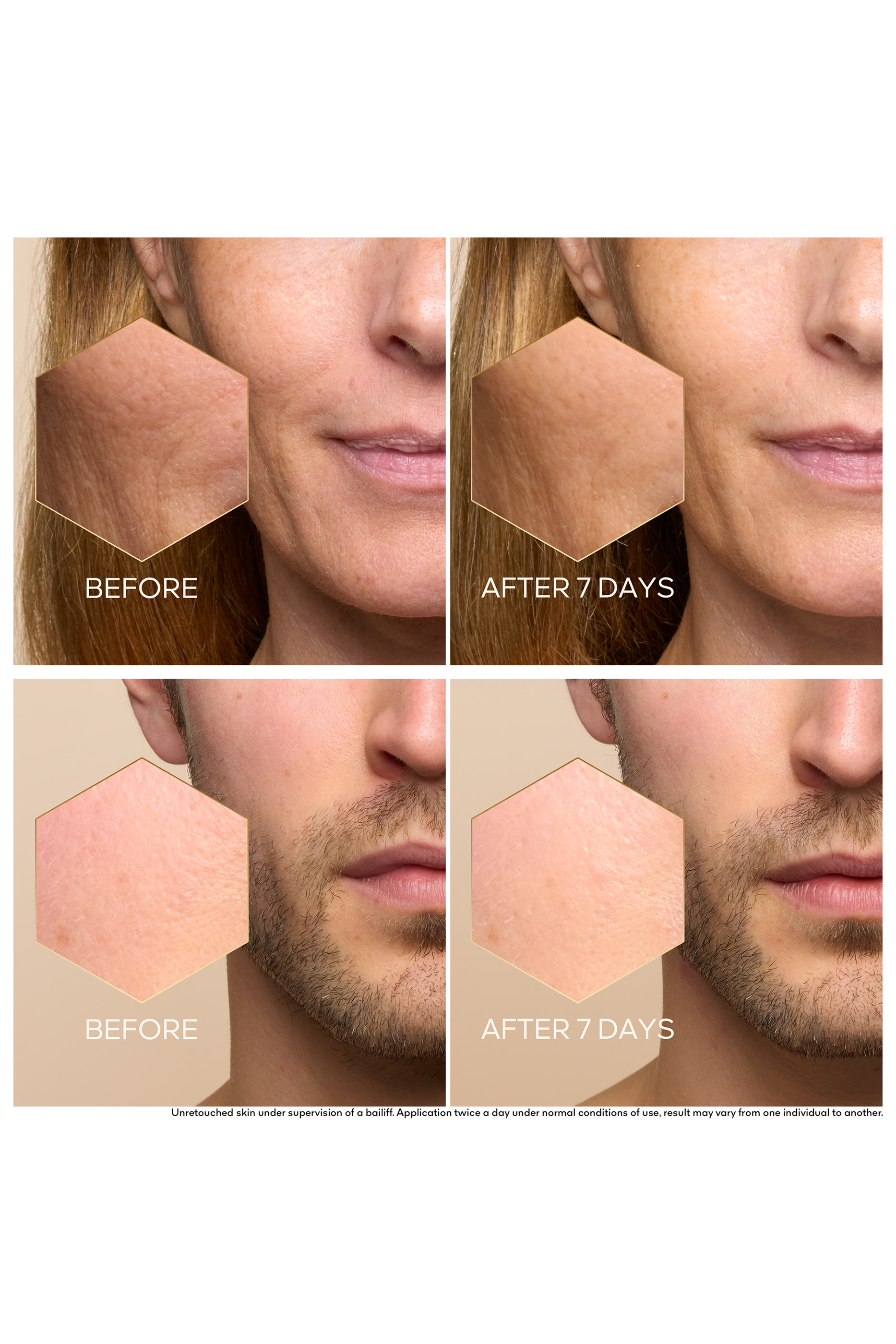 سيروم أباي رويال يوث واتري أويل