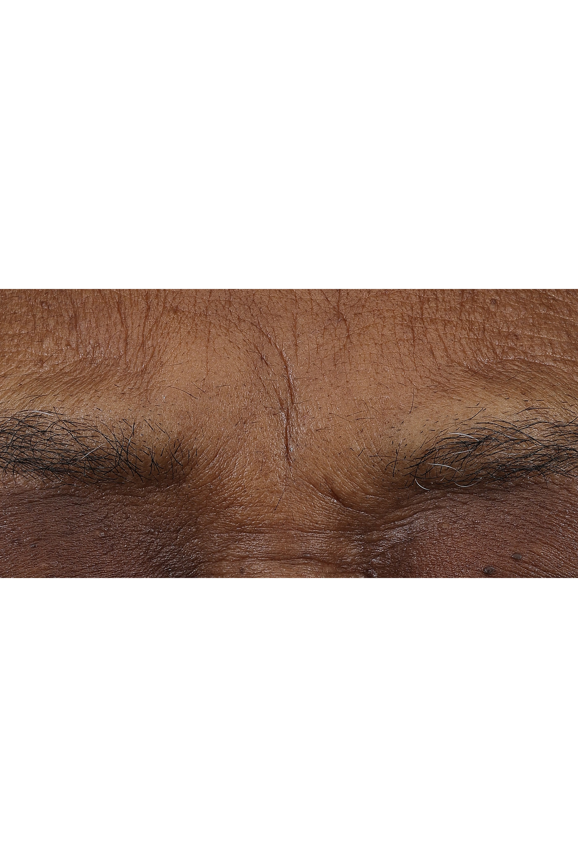 مرطب نهري وليلي سمارت كلينيكال ريبير بالريتينويد