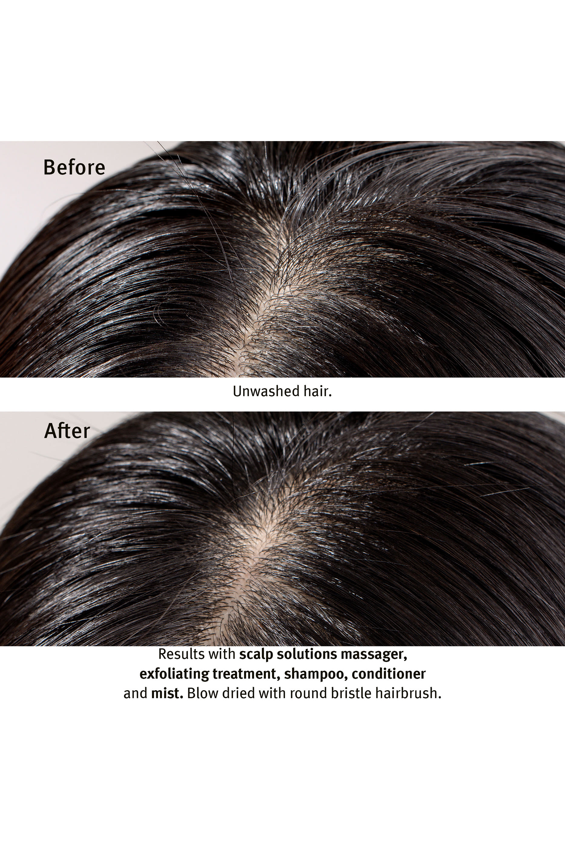 شامبو  سكالب سولوشنز لموازنة فروة الرأس