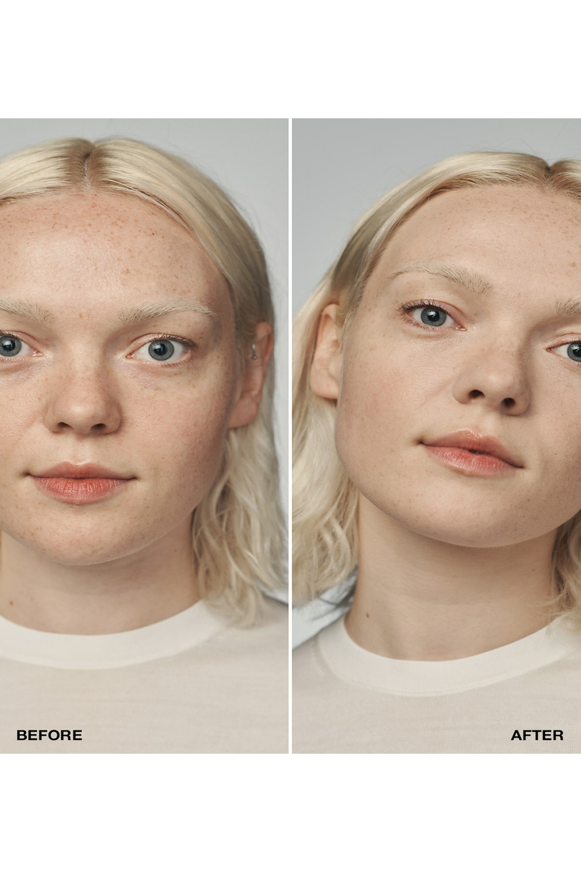 كريم أساس سيروم إيفين بيتر كلينيكال