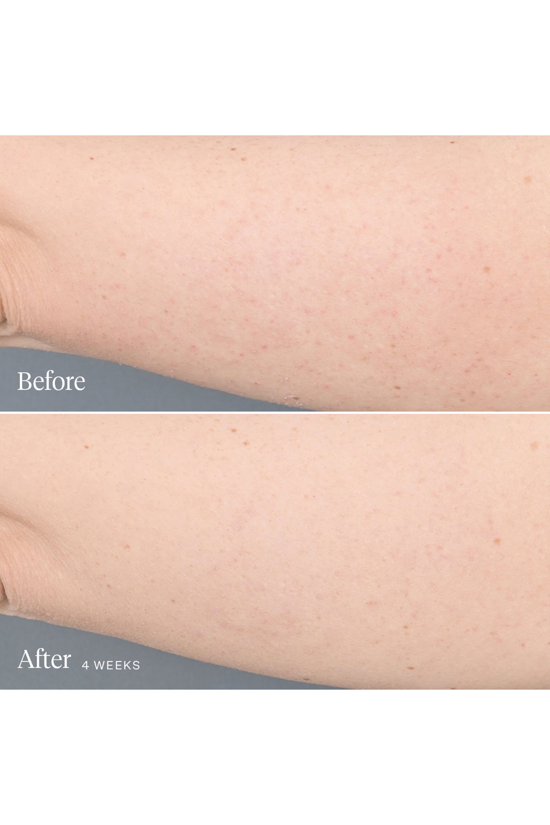 سيروم الجسم كاليدوسكوب لتنعيم البشرة