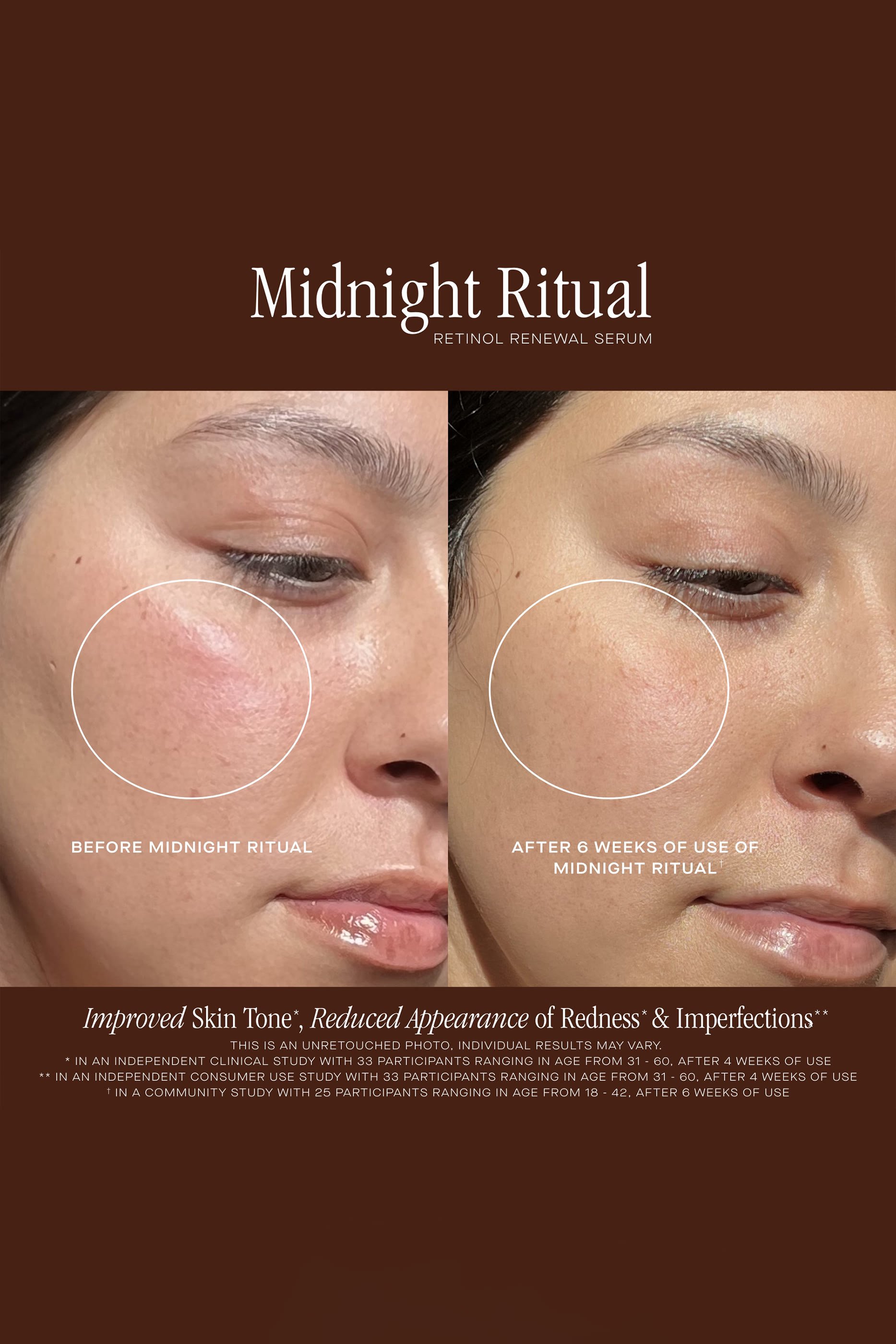 سيروم ليلي ريتوال ريتينول