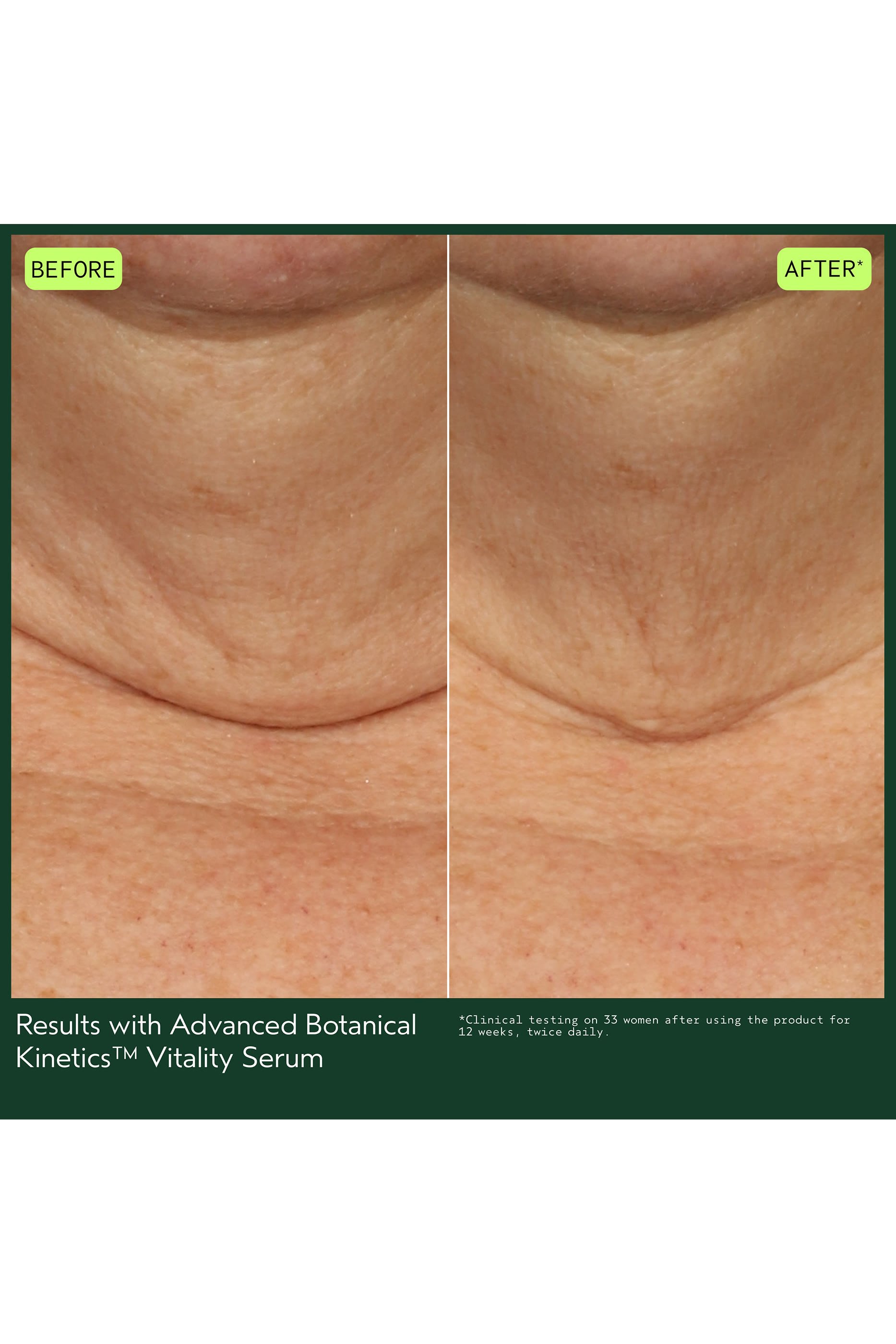 سيروم فايتاليتي أدفانسد بوتانيكال كينيتكس