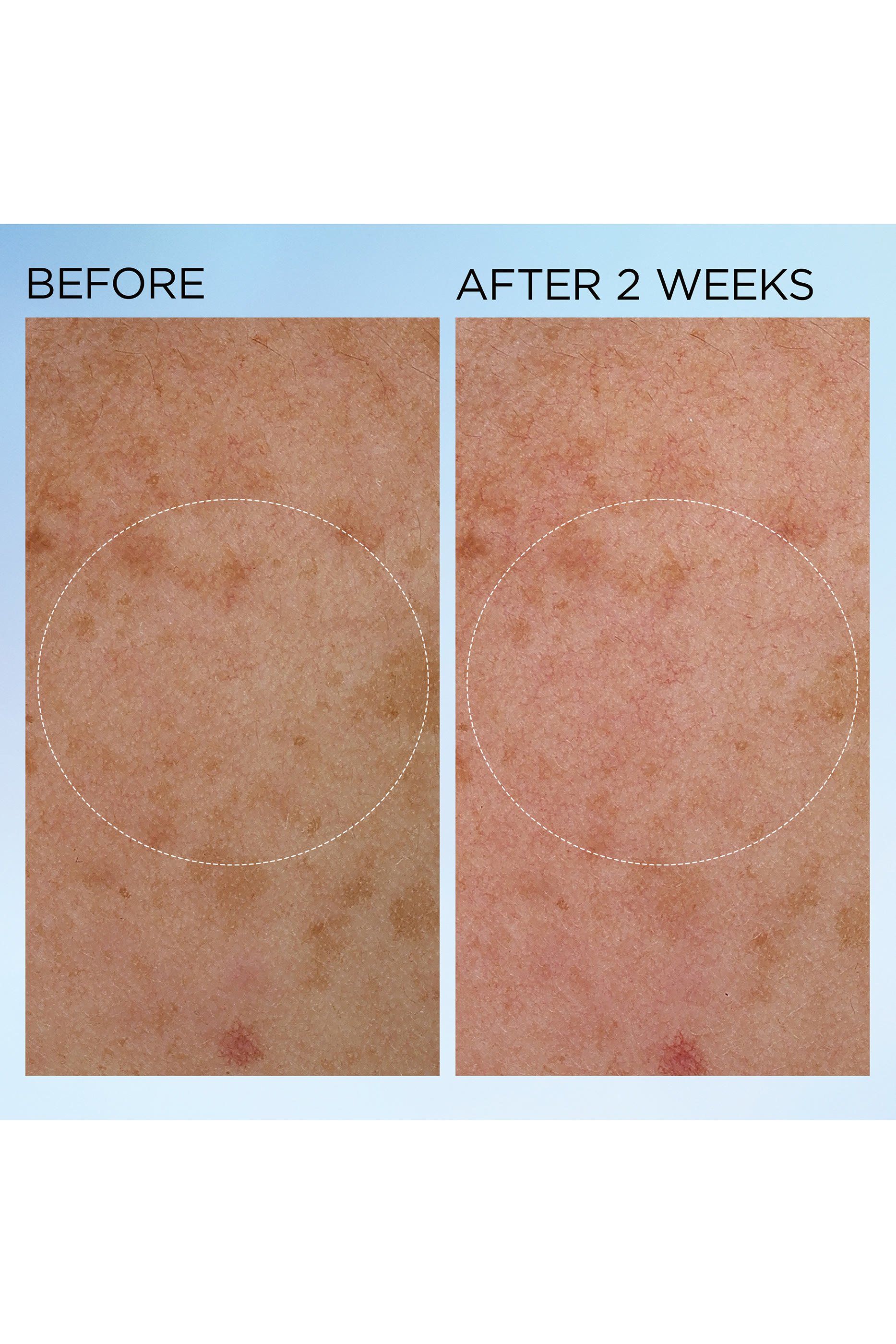 كريم لتفتيح البشرة وإكسابها الإشراق والمرونة بشكل ملحوظ