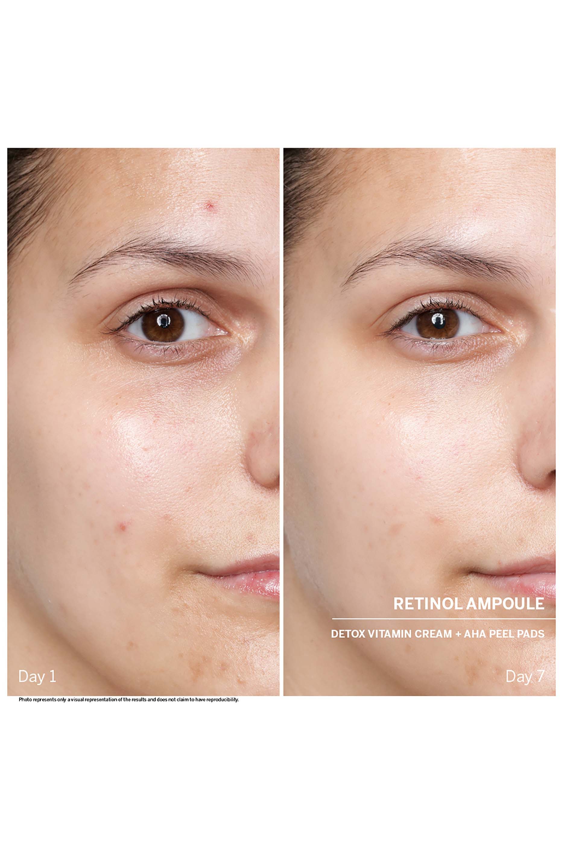 مجموعة أمبولة باور سيروم: ريتينول، 7 قطع